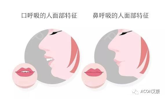 過(guò)敏性鼻炎會(huì)讓孩子變傻？！家長(zhǎng)該如何應(yīng)對(duì)